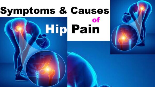 Symptoms of Hip Pain and Causes of Hip Pain in Ladies + Hip pain ...